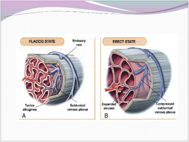 Symptoms of Priapism