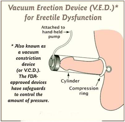 vacuum erection device