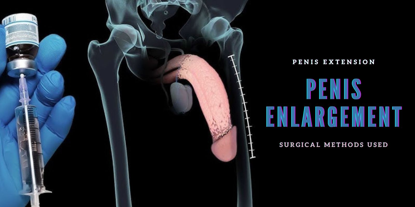 penis girth enhancement,